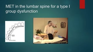 MET in the lumbar spine for a type I
group dysfunction
 