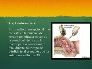  c) Cordocentesis
Es un método excepcional que
consiste en la punción del
cordón umbilical a través de
la pared del vientre de la
madre para obtener sangre
fetal directa. Su riesgo de
pérdida fetal es mayor que los
anteriores métodos (3%).
 