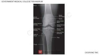 First Year Radiography Notes Radiology anatomy first year images xrays | PDF