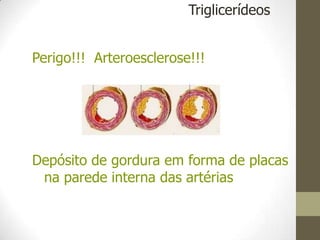 Perigo!!! Arteroesclerose!!!
Depósito de gordura em forma de placas
na parede interna das artérias
Triglicerídeos
 