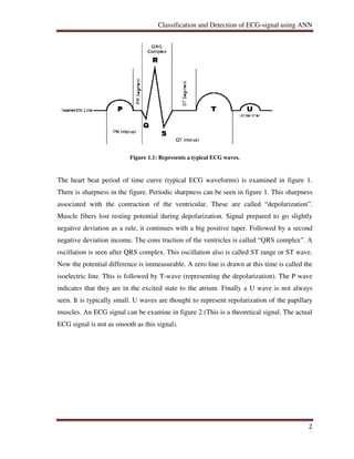 Classification and Detection of ECG-signals using Artificial Neural ...