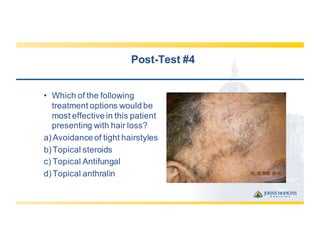 Post-­Test  #4
• Which  of  the  following  
treatment  options  would  be  
most  effective  in  this  patient  
presenting  with  hair  loss?
a)Avoidance  of  tight  hairstyles
b)Topical  steroids
c) Topical  Antifungal
d)Topical  anthralin
 
