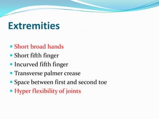 Extremities
 Short broad hands
 Short fifth finger
 Incurved fifth finger
 Transverse palmer crease
 Space between first and second toe
 Hyper flexibility of joints
 