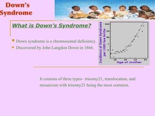 Downs Syndrome | PPT