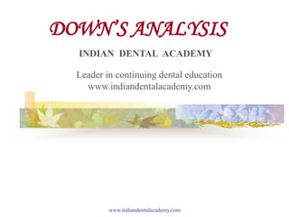 DOWN’S ANALYSIS
www.indiandentalacademy.com
INDIAN DENTAL ACADEMY
Leader in continuing dental education
www.indiandentalacademy.com
 