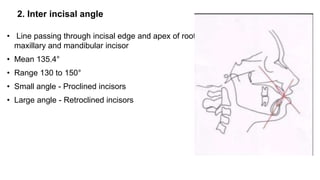 2. Inter incisal angle
• Line passing through incisal edge and apex of root of
maxillary and mandibular incisor
• Mean 135.4°
• Range 130 to 150°
• Small angle - Proclined incisors
• Large angle - Retroclined incisors
 