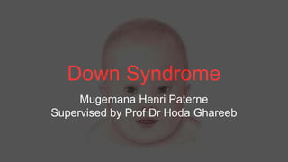 Down Syndrome
Mugemana Henri Paterne
Supervised by Prof Dr Hoda Ghareeb
 
