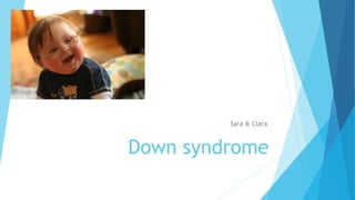 Down syndrome
Sara & Clara
 