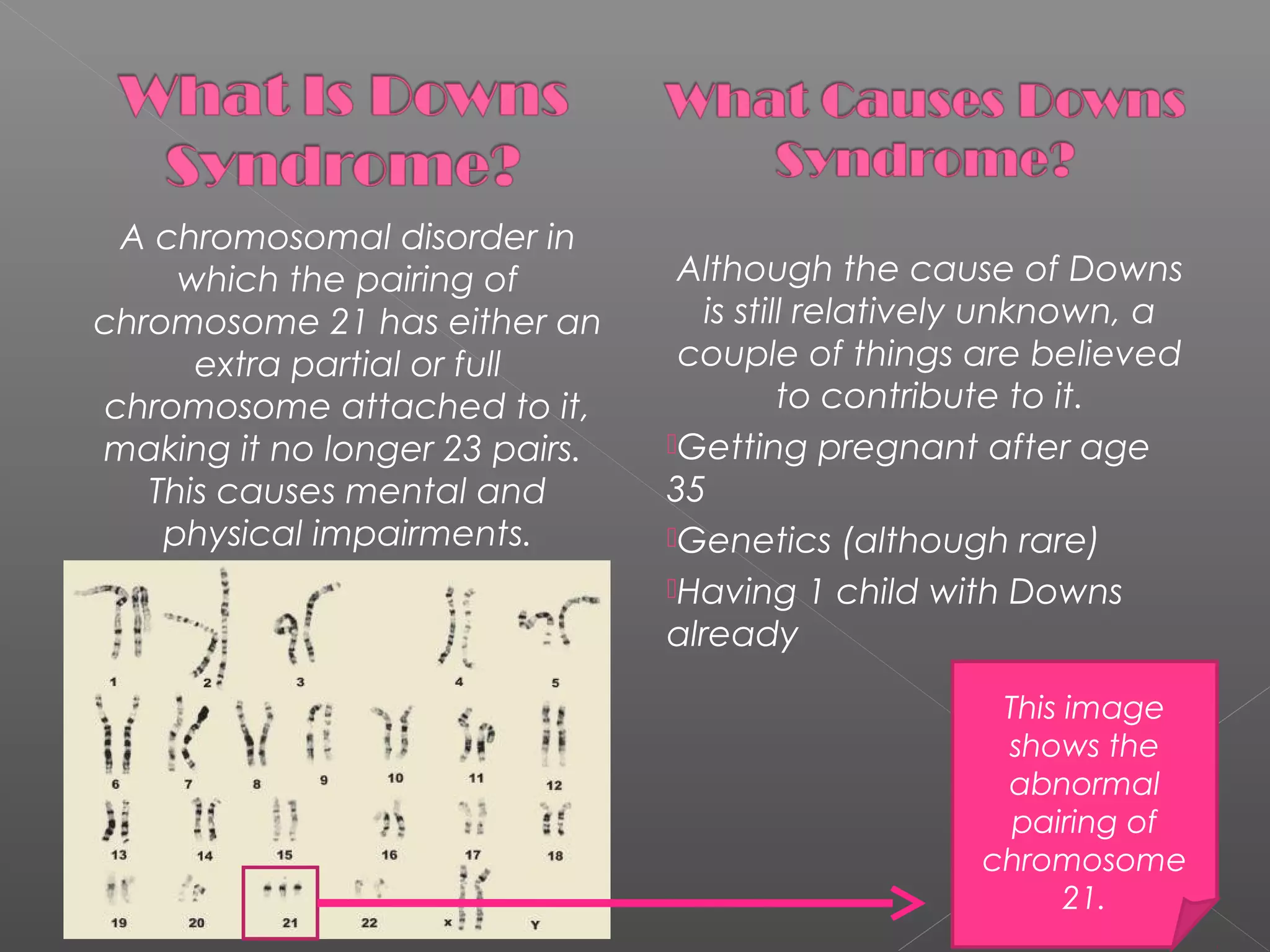 A chromosomal disorder in
which the pairing of
chromosome 21 has either an
extra partial or full
chromosome attached to it,
making it no longer 23 pairs.
This causes mental and
physical impairments.

Although the cause of Downs
is still relatively unknown, a
couple of things are believed
to contribute to it.
Getting pregnant after age
35
Genetics (although rare)
Having 1 child with Downs
already
This image
shows the
abnormal
pairing of
chromosome
21.

 