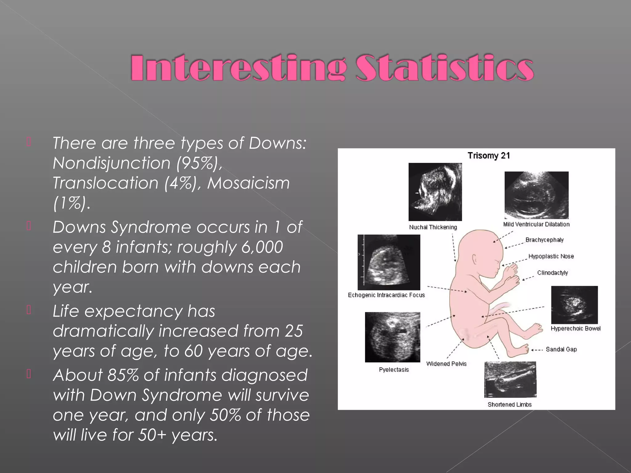 







There are three types of Downs:
Nondisjunction (95%),
Translocation (4%), Mosaicism
(1%).
Downs Syndrome occurs in 1 of
every 8 infants; roughly 6,000
children born with downs each
year.
Life expectancy has
dramatically increased from 25
years of age, to 60 years of age.
About 85% of infants diagnosed
with Down Syndrome will survive
one year, and only 50% of those
will live for 50+ years.

 