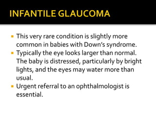  This very rare condition is slightly more
common in babies with Down’s syndrome.
 Typically the eye looks larger than normal.
The baby is distressed, particularly by bright
lights, and the eyes may water more than
usual.
 Urgent referral to an ophthalmologist is
essential.
 