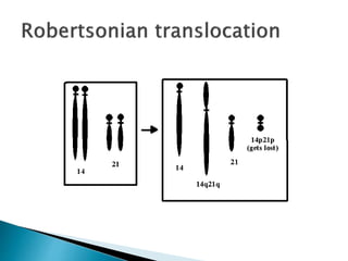 Downs syndrome | PPTX