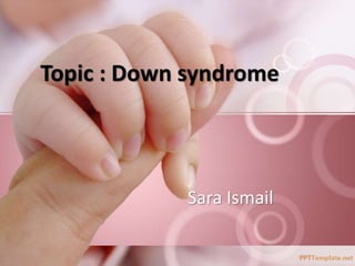 Sara Ismail
Topic : Down syndrome
 