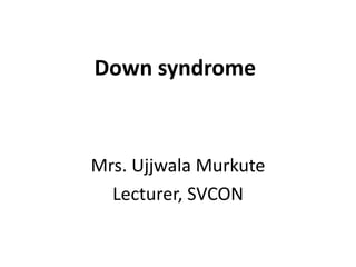 Down syndrome
Mrs. Ujjwala Murkute
Lecturer, SVCON
 