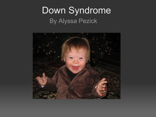 Down Syndrome
By Alyssa Pezick
 