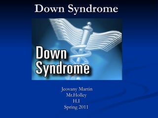 Down Syndrome Jeovany Martin Mr.Holley H.I Spring 2011 