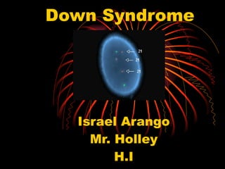 Down Syndrome Israel Arango Mr. Holley H.I 4/7/2011 