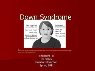 Down Syndrome  Theodora Po  Mr. Holley  Human Interaction  Spring 2011 ( http://www.google.com/imgres?imgurl=http://pubs.niaaa.nih.gov/publications/aa63/images/fas.gif&imgrefurl=http:// pubs.niaaa.nih.gov /publications ) 
