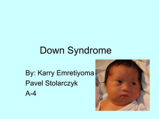 Down Syndrome By: Karry Emretiyoma Pavel Stolarczyk A-4 