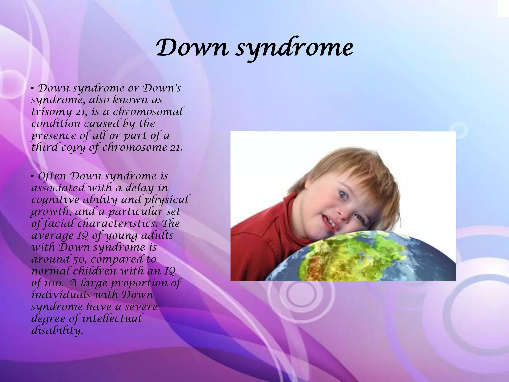 Down syndrome
• Down syndrome or Down's
syndrome, also known as
trisomy 21, is a chromosomal
condition caused by the
presence of all or part of a
third copy of chromosome 21.
• Often Down syndrome is
associated with a delay in
cognitive ability and physical
growth, and a particular set
of facial characteristics. The
average IQ of young adults
with Down syndrome is
around 50, compared to
normal children with an IQ
of 100. A large proportion of
individuals with Down
syndrome have a severe
degree of intellectual
disability.