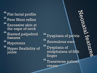 Neon
 Flat facial profile




                                            Neon
 Poor Moro reflex
 Excessive skin at




                                                at al f
                                                 at al f
  the nape of neck
 Slanted palpebral  Dysplasia of pelvis
  fissures




                                                        eatu
                                                         eatur
 Hypotonia             Anomalous ears
 Hyper flexibility of  Dysplasia of of fifth




                                                             res
  joints                 midphalanx




                                                               es
                         finger
                        Transverse palmer
                         crease
 