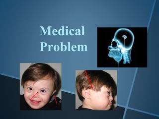 Medical
Problem
 