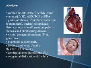 Newborn

• cardiac defects (50% ): AVSD [most
common], VSD, ASD, TOF or PDA
• gastrointestinal (12%): duodenal atresia
[commonest], tracheo-oesophageal
fistula, anorectal malformation, pyloric
stenosis and Hirshsprung disease.
• vision: congenital cataracts (3%),
glaucoma.
• hypotonia & joint laxity
• feeding problems. Usually
Resolve in few weeks.
• congenital hypothyroidism (1%)
• congenital dislocation of the hips
 