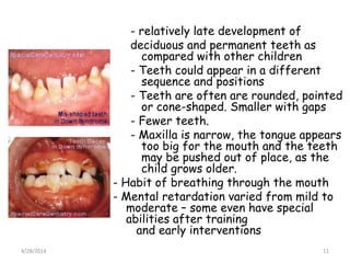 - relatively late development of
deciduous and permanent teeth as
compared with other children
- Teeth could appear in a d...