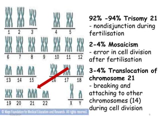 92% -94% Trisomy 21
- nondisjunction during
fertilisation
2-4% Mosaicism
- error in cell division
after fertilisation
3-4%...