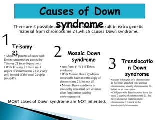 Causes of Down
syndromeThere are 3 possible abnormalities which all result in extra genetic
material from chromosome 21,which causes Down syndrome.
1Trisomy
21• About 95 percent of cases with
Down syndrome are caused by
Trisomy 21 (non disjunction).
• With Trisomy 21 there are 3
copies of chromosome 21 in every
cell, instead of the usual 2 copies
(total 47).
2 Mosaic Down
syndrome
• rare form (1 % ) of Down
syndrome
• With Mosaic Down syndrome
some cells have an extra copy of
chromosome 21, but not all.
• Mosaic Down syndrome is
caused by abnormal cell division
after fertilization (during
embryogenesis).
3 Translocatio
n Down
syndrome
• occurs when part of a chromosome
21 becomes attached onto another
chromosome, usually chromosome 14,
before or at conception.
• Children with Translocation have the
usual 2 copies of chromosome 21, but
have additional material from
chromosome 21 stuck to the
translocated chromosome.
MOST cases of Down syndrome are NOT inherited.
 