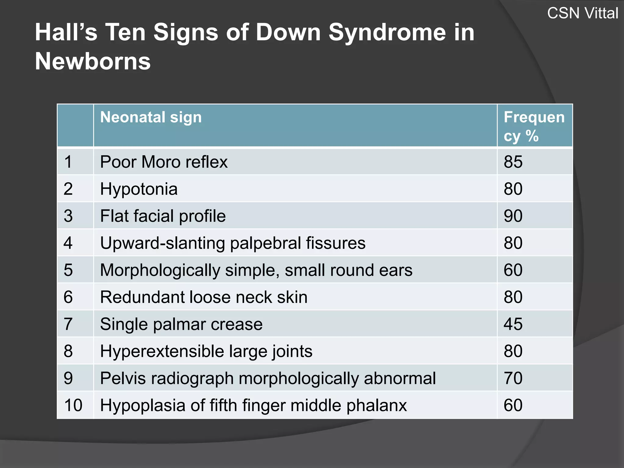 Down Syndrome