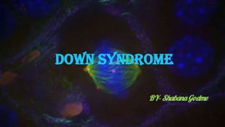 DOWN SYNDROME
BY- ShabanaGodme
 