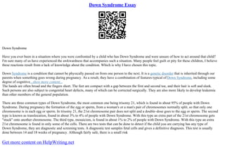 Down Syndrome Essay
Down Syndrome
Have you ever been in a situation where you were confronted by a child who has Down Syndrome and were unsure of how to act around that child?
I'm sure many of us have experienced the awkwardness that accompanies such a situation. Many people feel guilt or pity for these children, I believe
these reactions result from a lack of knowledge about the condition. Which is why I have chosen this topic.
Down Syndrome is a condition that cannot be physically passed on from one person to the next. It is a genetic disorder that is inherited through our
parents when something goes wrong during pregnancy. As a result, they have a combination of features typical ofDown Syndrome, including some
degree of cognitive...show more content...
The hands are often broad and the fingers short. The feet are compact with a gap between the first and second toe, and their hair is soft and sleek.
Such persons are also subject to congenital heart defects, many of which can be corrected surgically. They are also more likely to develop leukemia
than other members of the general population.
There are three common types of Down Syndrome, the most common one being trisomy 21, which is found in about 95% of people with Down
Syndrome. During pregnancy the formation of the egg or sperm, from a woman's or a man's pair of chromosomes normally split, so that only one
chromosome is in each egg or sperm. In trisomy 21, the 21st chromosome pair does not split and a double–dose goes to the egg or sperm. The second
type is known as translocation, found in about 3% to 4% of people with Down Syndrome. With this type an extra part of the 21st chromosome gets
"stuck" onto another chromosome. The third type, mosaicism, is found in about 1% to 2% of people with Down Syndrome. With this type an extra
21st chromosome is found in only some of the cells. There are two tests that can be done to detect if the child you are carrying has any type of
Down Syndrome, they are diagnostic and screening tests. A diagnostic test samples fetal cells and gives a definitive diagnosis. This test is usually
done between 14 and 18 weeks of pregnancy. Although fairly safe, there is a small risk
Get more content on HelpWriting.net
 