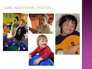 Down syndrome presentation | PPTX