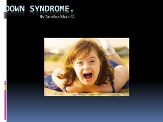 DOWN SYNDROME.
      By Tamiko-Shae 
 