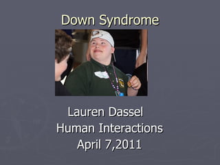 Down Syndrome ,[object Object],[object Object],[object Object]