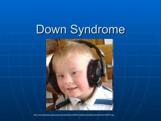 Down Syndrome http://www.filteredsoundtraining.net/media/Boy%20WIth%20Downs%20Syndrome%20in%20FST.jpg 