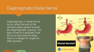 Diaphragmatic/Hiatal Hernia
Diaphragmatic or Hiatal Hernia
occurs when the part of the
stomach slides upward towards
the diaphragmatic opening. This
type of hernia is generally small
but once they become larger
there is a danger for organs to
slide upwards.
 