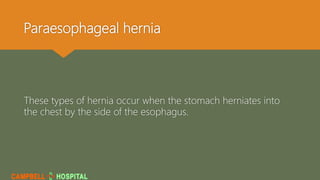 Paraesophageal hernia
These types of hernia occur when the stomach herniates into
the chest by the side of the esophagus.
 