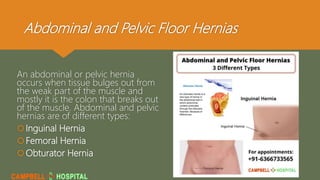 Abdominal and Pelvic Floor Hernias
An abdominal or pelvic hernia
occurs when tissue bulges out from
the weak part of the muscle and
mostly it is the colon that breaks out
of the muscle. Abdominal and pelvic
hernias are of different types:
Inguinal Hernia
Femoral Hernia
Obturator Hernia
 