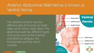 Anterior Abdominal Wall Hernia is known as
Ventral Hernia
The abdominal floor has two
different sets of muscles on both
sides which mirror each other. The
abdominal wall has different types
of muscles such as the internal
and external obliques, the
transversalis and the rectus
muscles.
 