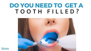 Do You Need to Get a Tooth Filled?.pptx