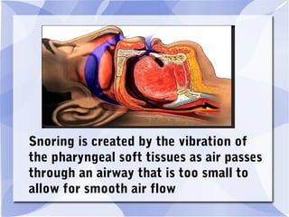 Snoring is created by the vibration of
the pharyngeal soft tissues as air passes
through an airway that is too small to
allow for smooth air flow
 
