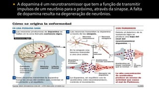  A dopamina é um neurotransmissor que tem a função de transmitir
impulsos de um neurônio para o próximo, através da sinapse. A falta
de dopamina resulta na degeneração de neurônios.
 