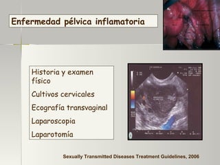 Historia y examen físico Cultivos cervicales Ecografía transvaginal Laparoscopia  Laparotomía  Enfermedad pélvica inflamatoria Sexually Transmitted Diseases Treatment Guidelines, 2006 