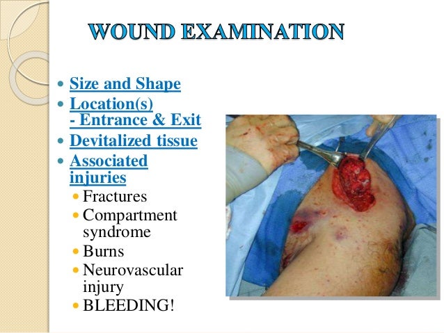 Soft Tissue Debridement Definition And Pronunciation