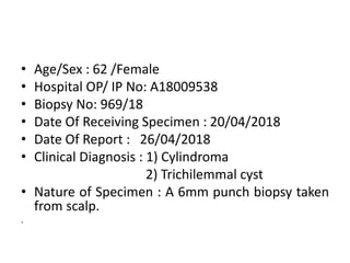 • Age/Sex : 62 /Female
• Hospital OP/ IP No: A18009538
• Biopsy No: 969/18
• Date Of Receiving Specimen : 20/04/2018
• Date Of Report : 26/04/2018
• Clinical Diagnosis : 1) Cylindroma
2) Trichilemmal cyst
• Nature of Specimen : A 6mm punch biopsy taken
from scalp.
.
 