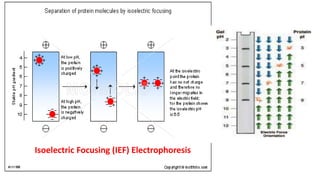 Isoelectric Focusing (IEF) Electrophoresis
 