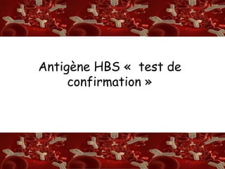 S/A 
Antigène HBS « test de 
confirmation » 
 