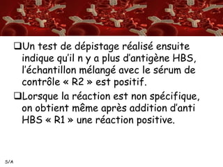 S/A 
Un test de dépistage réalisé ensuite 
indique qu’il n y a plus d’antigène HBS, 
l’échantillon mélangé avec le sérum de 
contrôle « R2 » est positif. 
Lorsque la réaction est non spécifique, 
on obtient même après addition d’anti 
HBS « R1 » une réaction positive. 
 